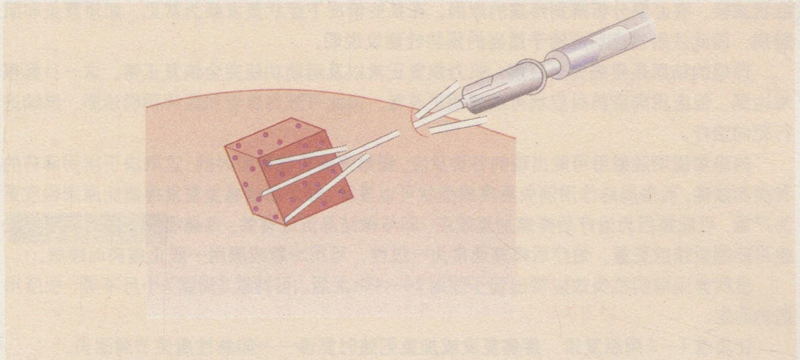 注射技術(shù)指南